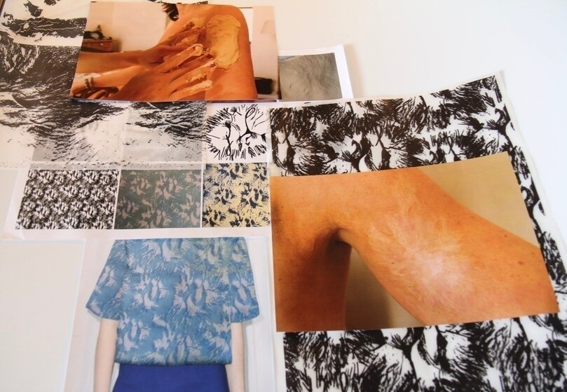 Printed scars, as a sign of life